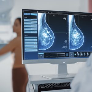 Mammograms Specialist Near Me in Houston, TX
