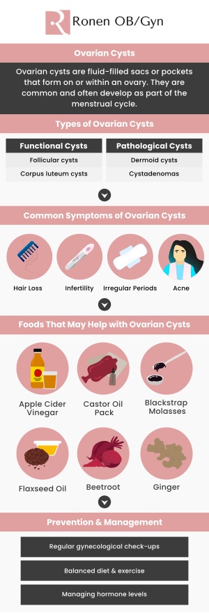 Common questions asked by patients: What causes ovarian cysts? How are ovarian cysts diagnosed? What are the common symptoms of ovarian cysts? What are the treatment options for ovarian cysts? For more information, contact us or schedule an appointment online. Our clinic is conveniently located at 950 Threadneedle, Suite 282, Houston, TX 77079. Common questions asked by patients: What causes ovarian cysts? How are ovarian cysts diagnosed? What are the common symptoms of ovarian cysts? What are the treatment options for ovarian cysts? For more information, contact us or schedule an appointment online. Our clinic is conveniently located at 950 Threadneedle, Suite 282, Houston, TX 77079.