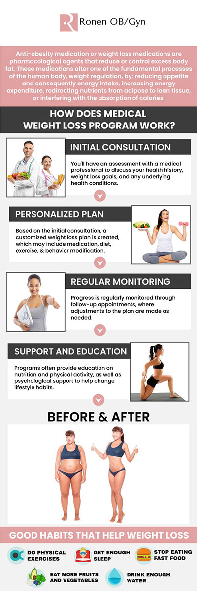 Medical Weight loss at Ronen OB/GYN, in Houston, TX